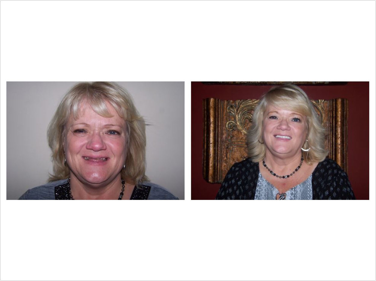 GBAS helps women like Dawn recover from domestic violence and rebuild their lives with confidence.