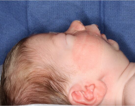 Photo courtesy of the Journal of Oral and Maxillofacial Surgery