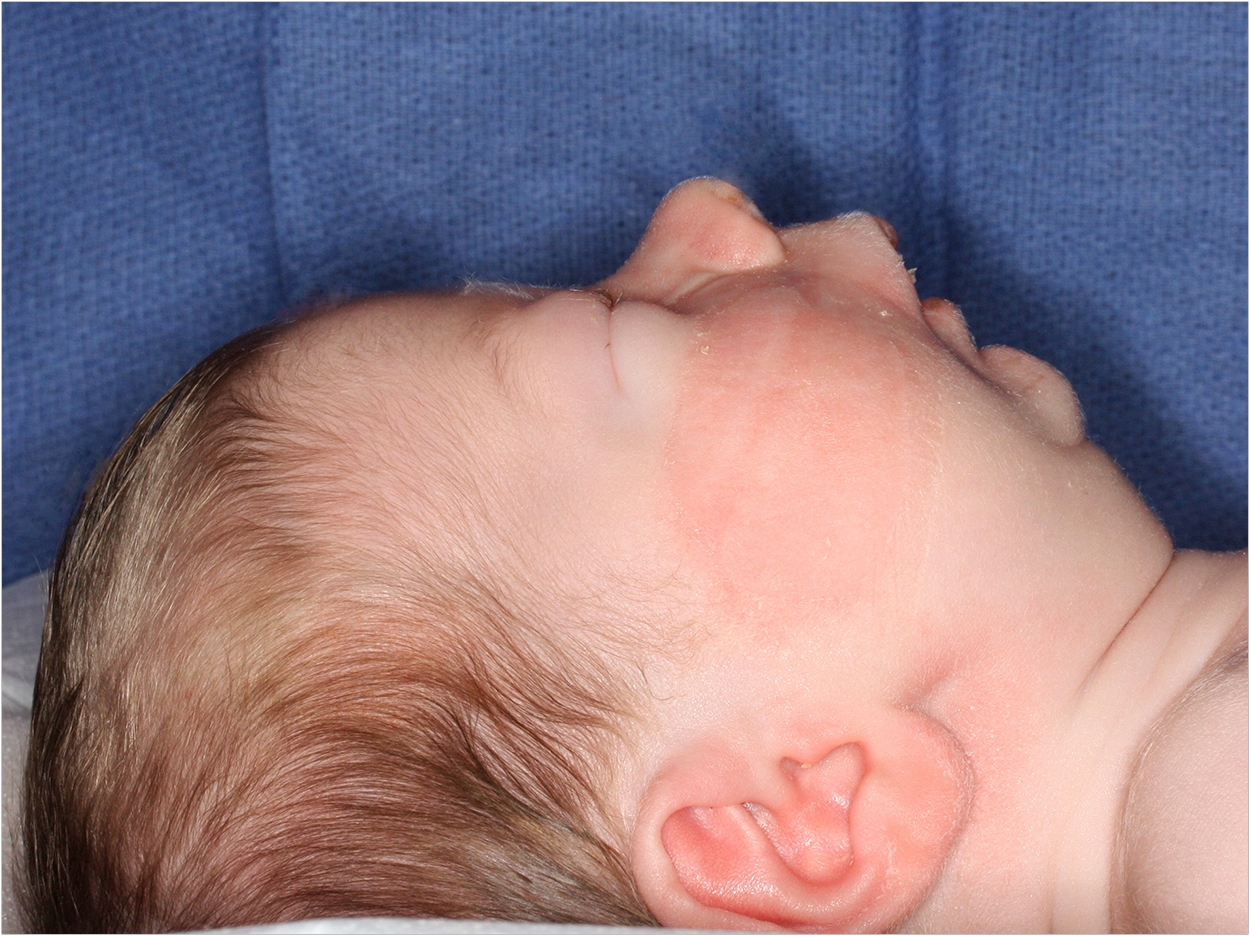 Photo courtesy of the Journal of Oral and Maxillofacial Surgery
