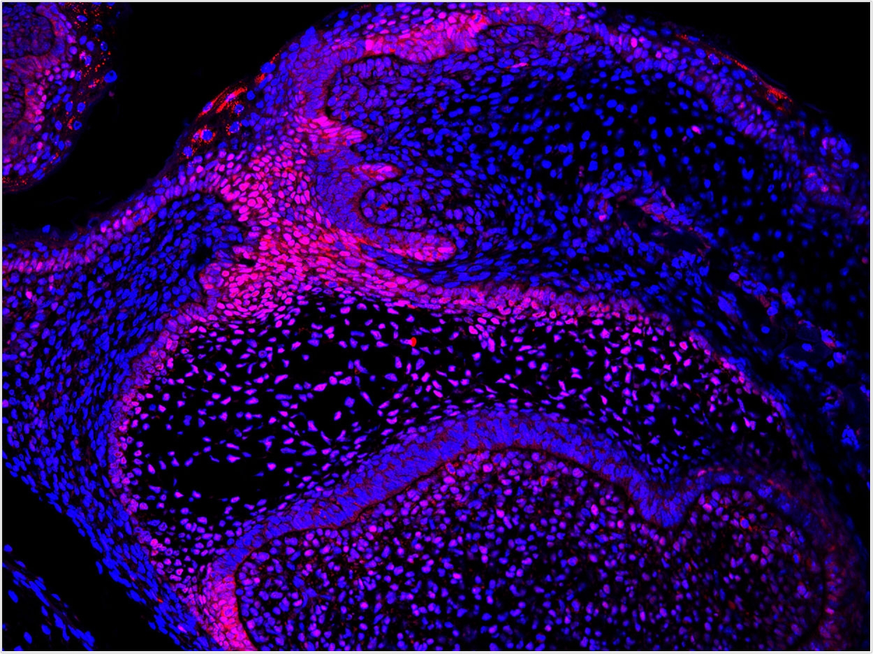 Development of a second generation tooth on the side of the first tooth in the mouse molar region.