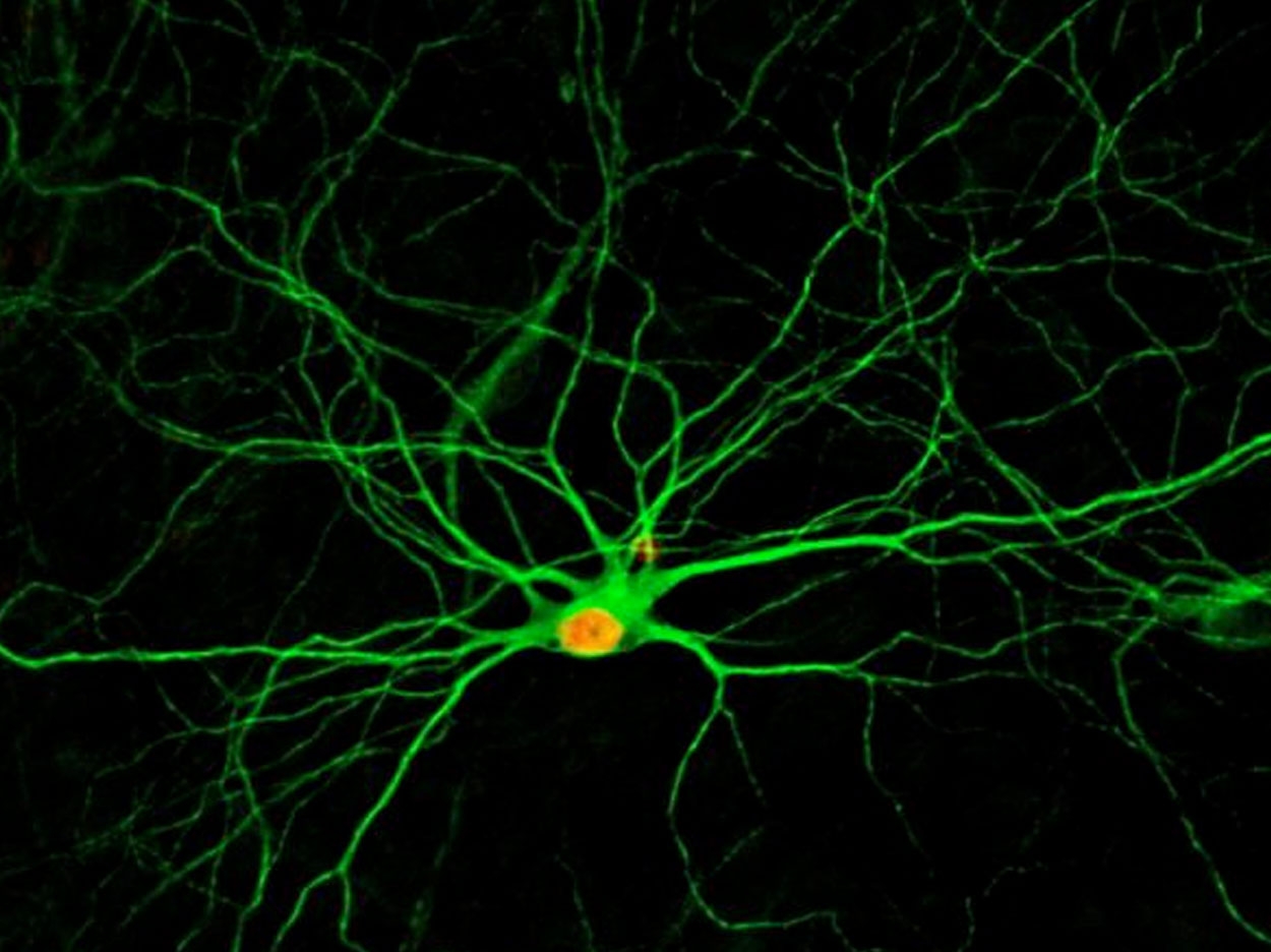 A simple treatment using four small molecules converts human astrocytes -- a common type of cells in the nervous system -- into new neurons, which develop complex structures after four months, as pictured. Credit: Gong Chen Lab, Penn State