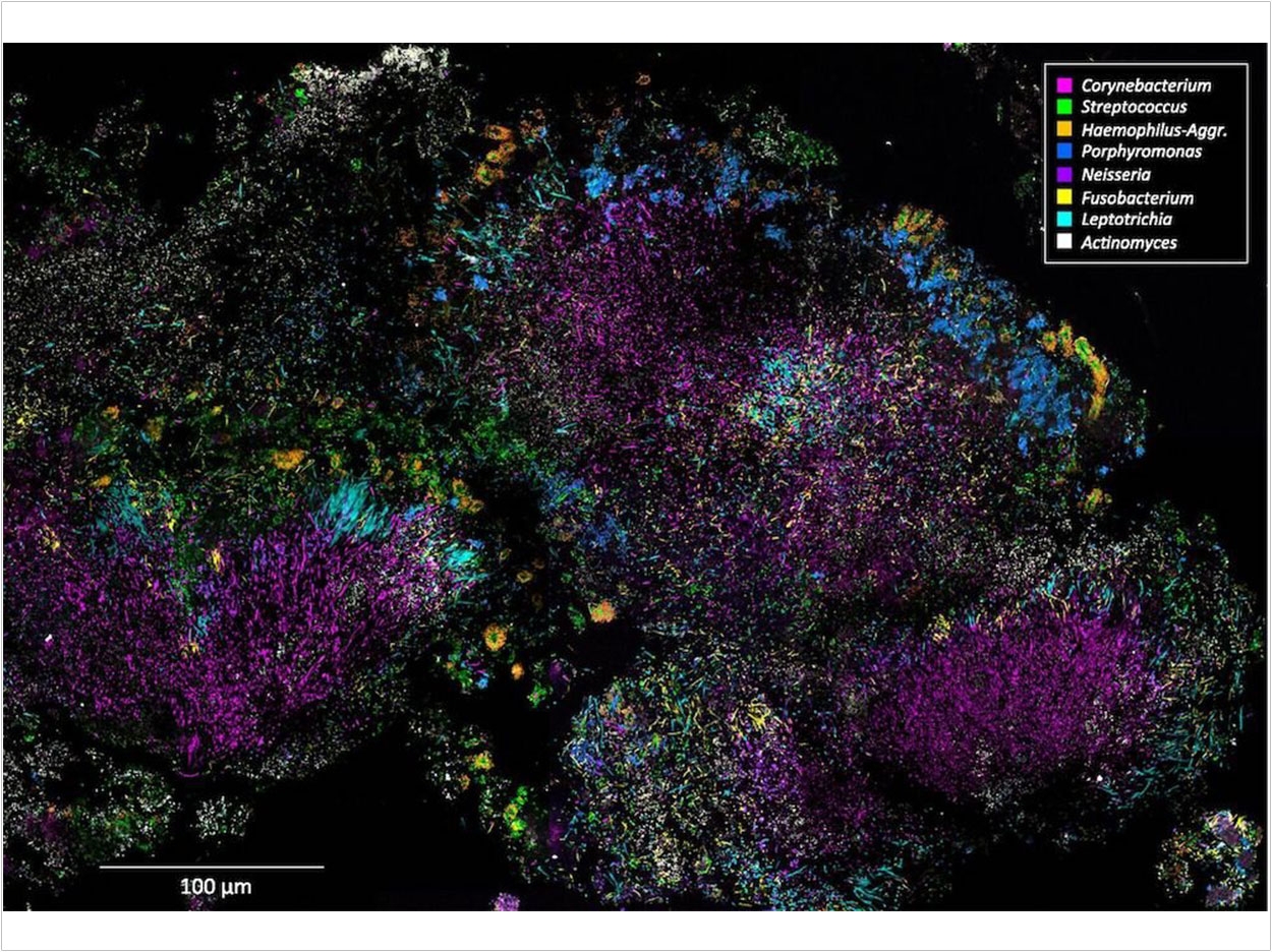 Scientists know the genetic makeup of about 70% of oral bacteria. What they don't know is which species would live the longest without nutrients in a Jessica Mark Welch and Gary Borisy, PNAS.1522149113