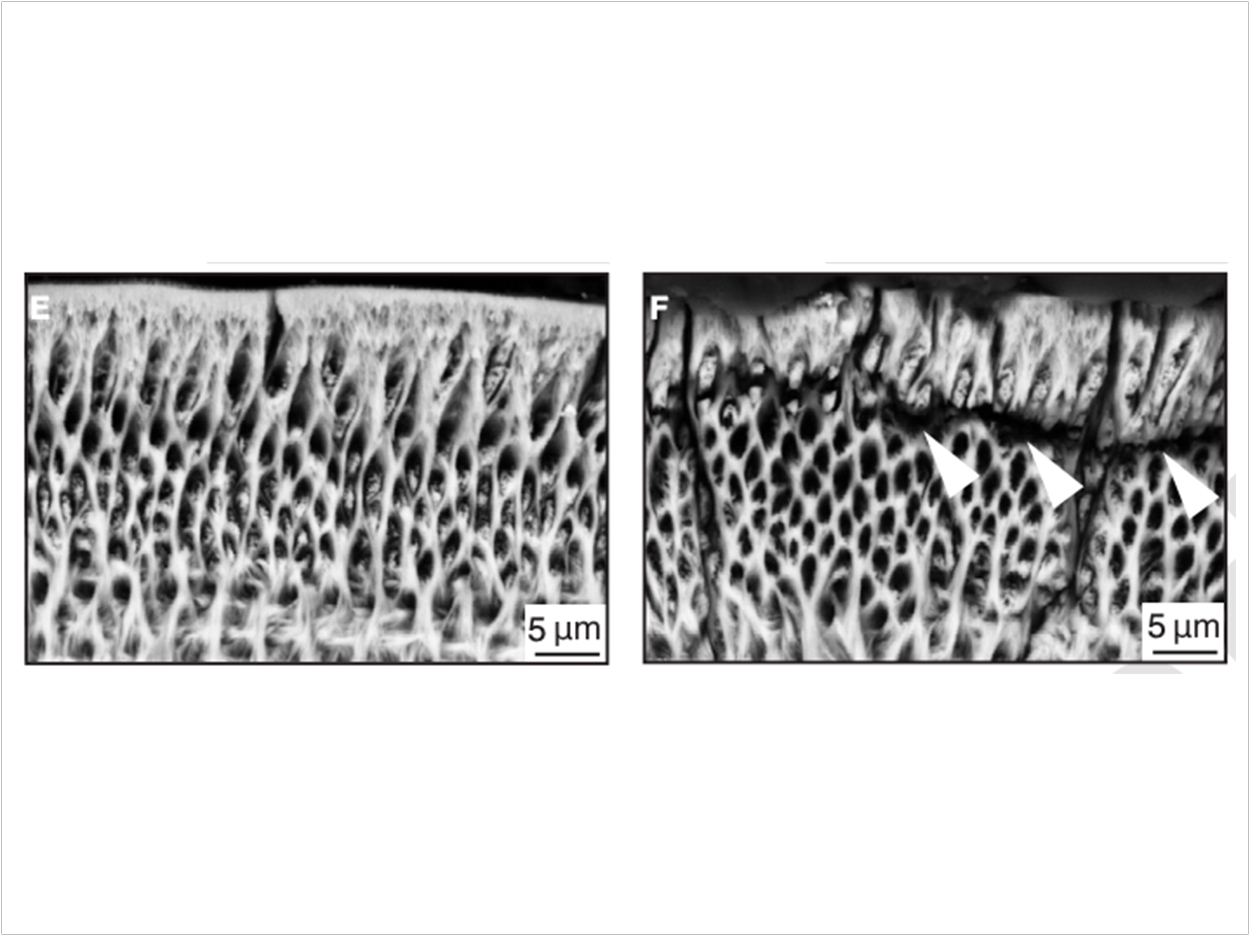 High-magnification of tooth enamel in normal (control) mice (left) and mice with ORAI1 gene mutation (right) by scanning electron microscope. Reprinted with permission from Eckstein et al., Sci. Signal. 12, eaav4663 (2019).
