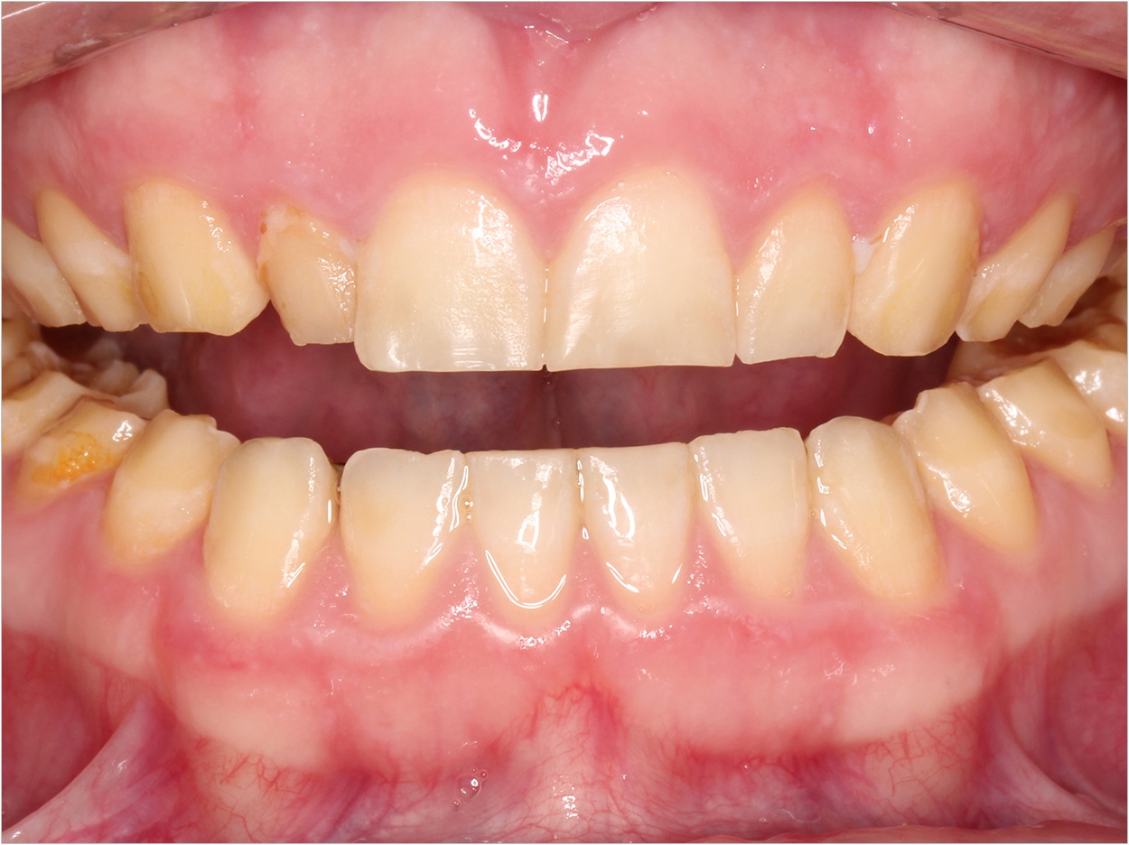 Photo by Dr. Tyler Wynne; dentistrytoday.com/articles/10497