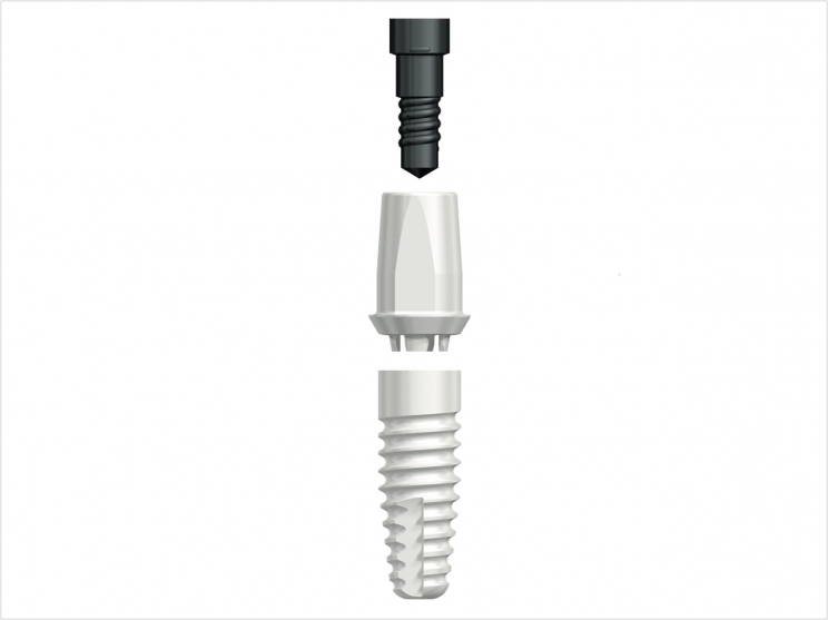 Nobel Biocare's Nobel Pearl two-piece ceramic implant.