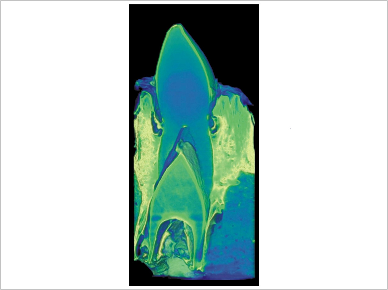 The team used a three-dimensional x-ray scanner to measure the thickness of tooth enamel in crocodiles. They found regardless of tooth position, age, or diet, crocodiles do not have thick tooth enamel.