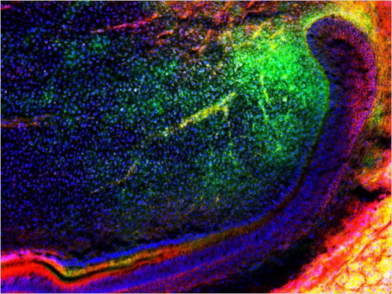 Mesenchymal stem cells (traced in green) migrate into a tooth to further regenerate the tissue and organ. Photo by University of Plymouth.