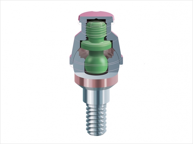 The Zest Dental Solutions Locator F-Tx attachment system.