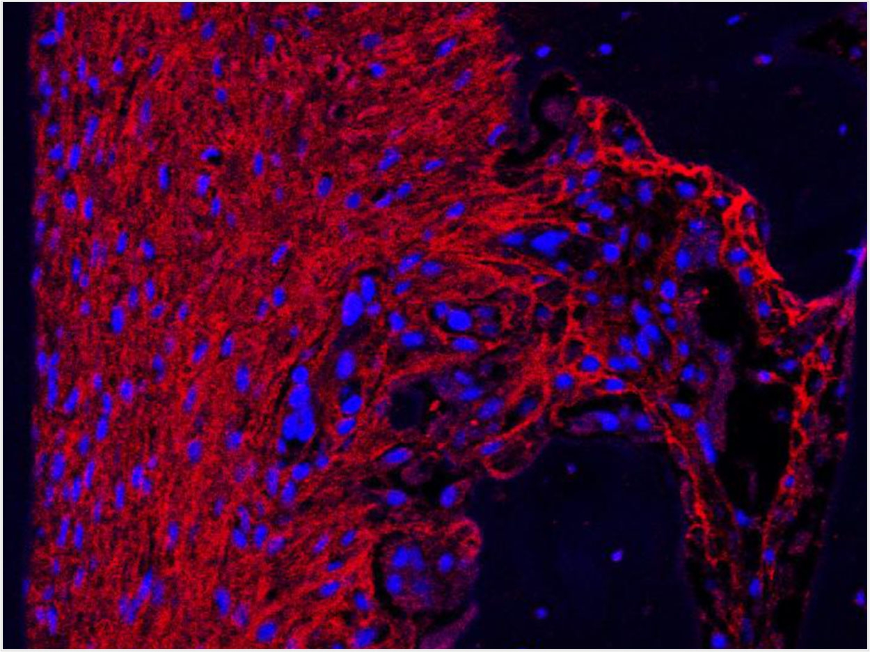 A key molecule named periostin (red color) is highly expressed by mature periodontal ligament. University of Plymouth