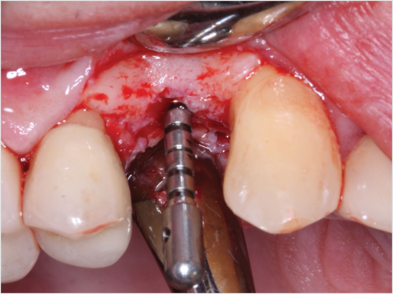 Photo by Dr. Gordon Christensen: dentistrytoday.com/articles/10574