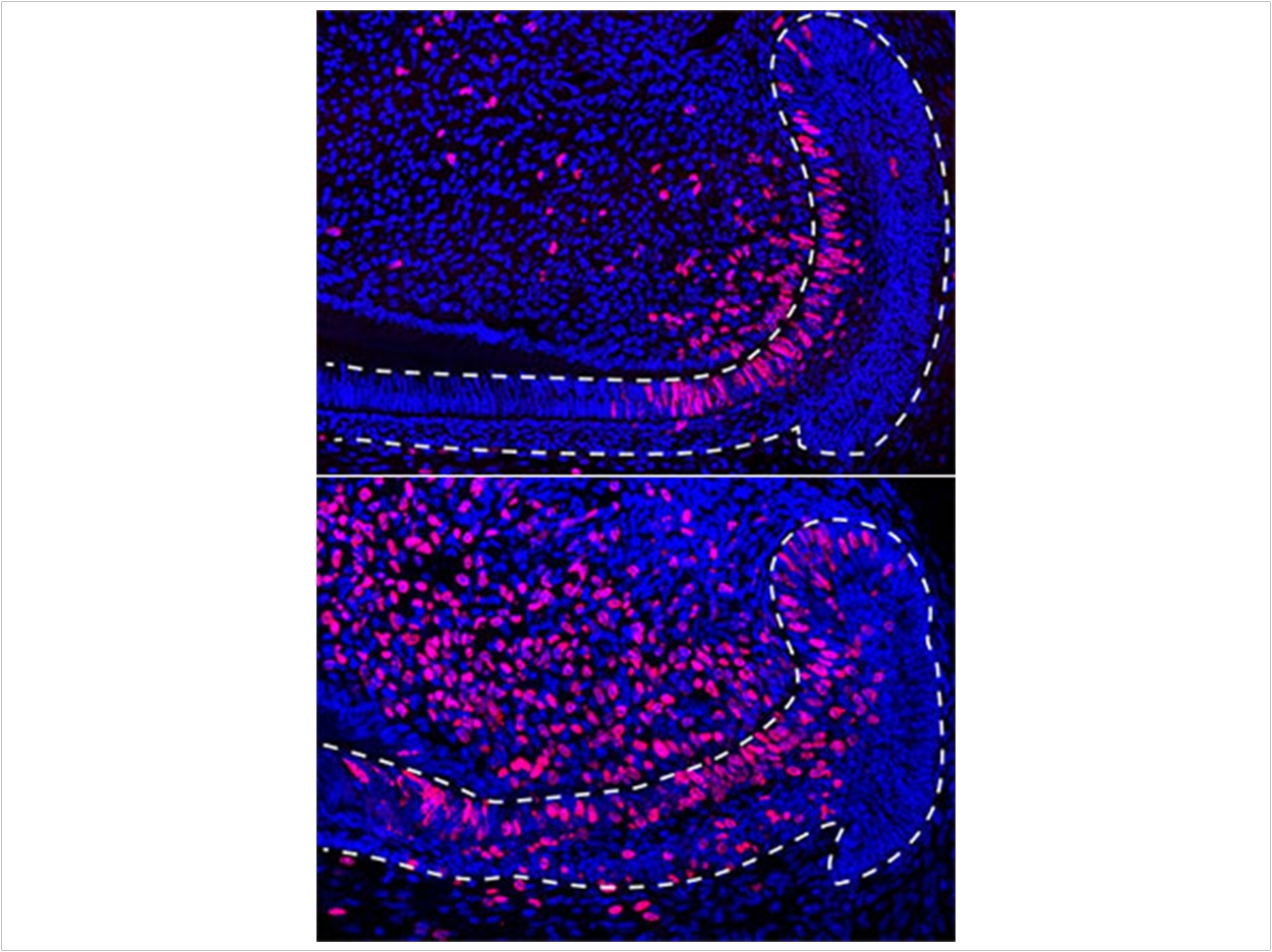 Stem cells (stained pink) become more numerous and divide more frequently in the epithelium of mouse incisors after injury (bottom), compared to undamaged tissue (top). Image courtesy Ophir Klein, UCSF