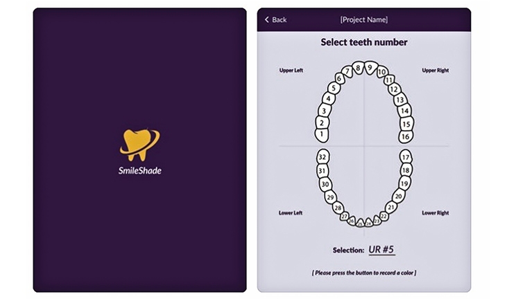 The Smile Shade app was developed to facilitate a simple, accurate, and systematic approach for dental shade determination.