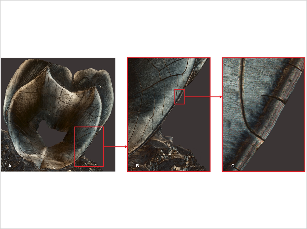 Panel A is a longitudinal section of the maxillary second molar of a 35-year-old female who had children at ages 19 and 24. Panel B is a zoomed-in section of Panel A. Panel C reveals, at left, the dentin, covered, at right, by the cementum, which presents two distinct darker “rings” that correspond to the two reproductive events. Image courtesy of Paola Cerrito.
