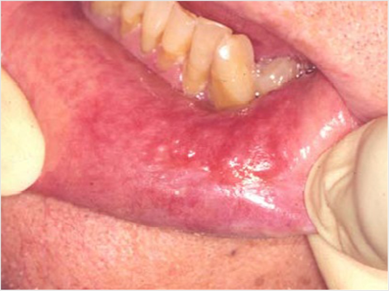 American Academy of Oral Medicine