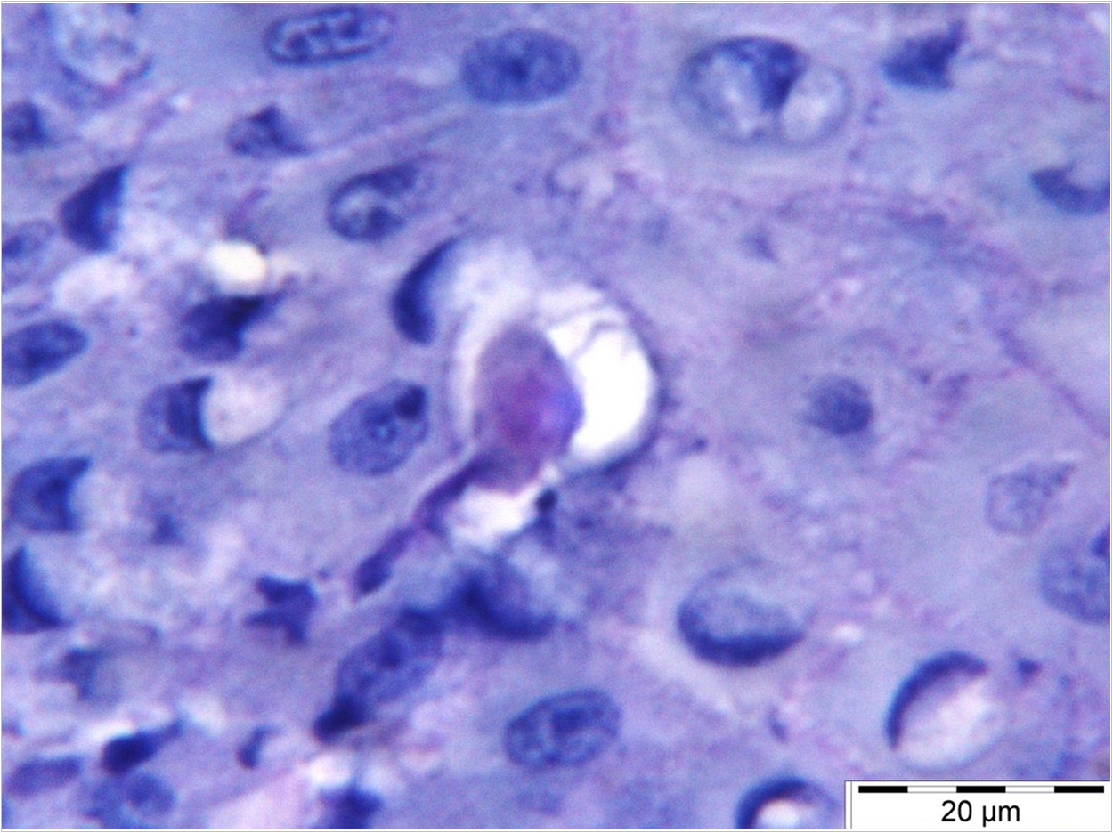The parasite Entamoeba gingivalis penetrates the gum tissue, feeding on host cells. Schaefer/Charité