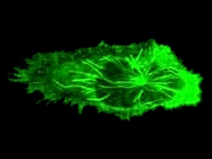 A crawling neutrophil, tubulin labeled green. Neutrophil activation is now believed to be at the root of overactive inflammatory responses and links conditions such as periodontal disease and heart disease. Credit: Noah Fine