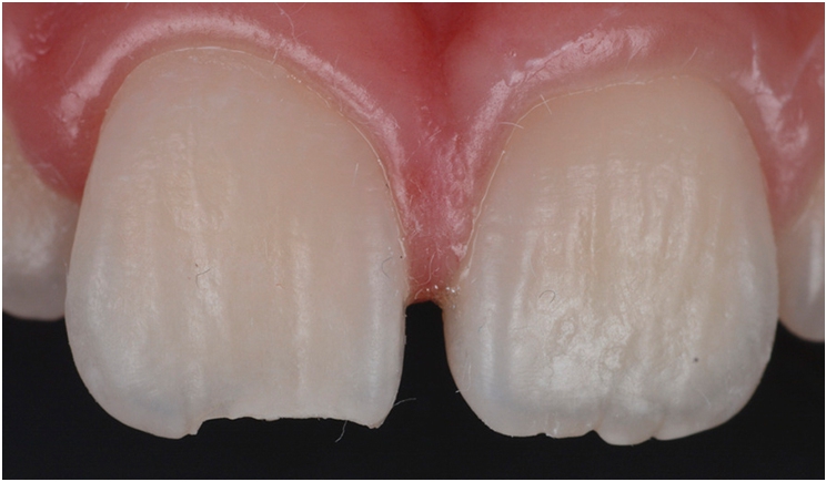 Figure 1. Pre-operative facial view.