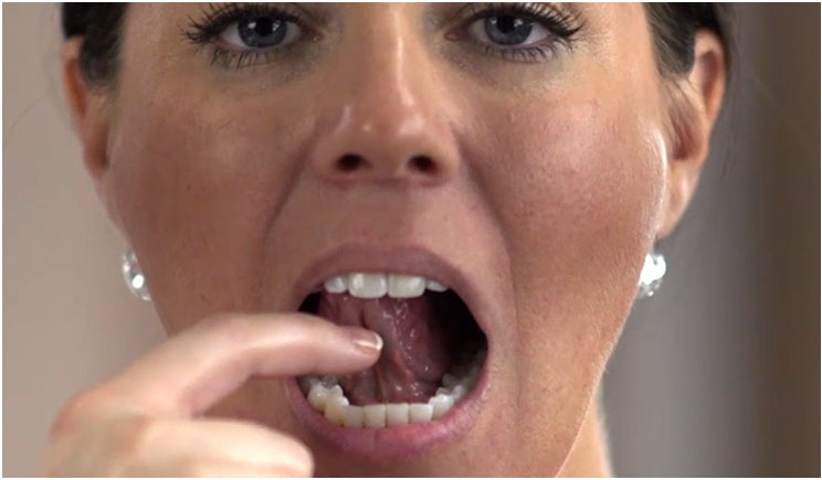 Courtesy of the Oral Cancer Foundation