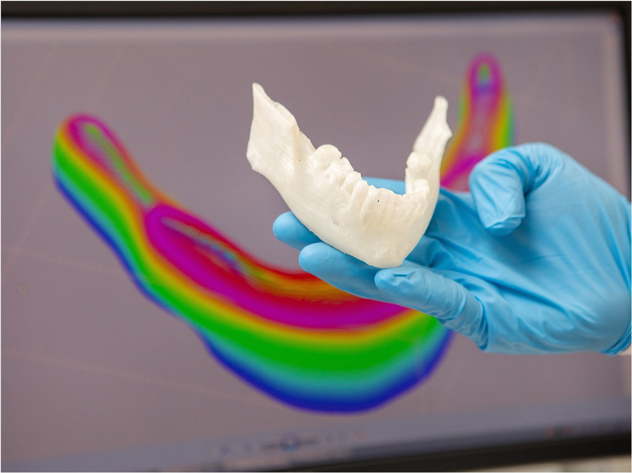 3D printed patient’s mandible scaffold generated by CT scanning, computer-aided design and computer-aided manufacturing technology for bone tissue regeneration.