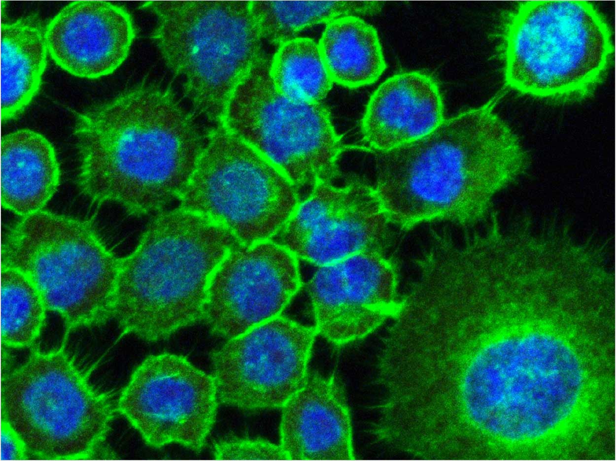 SCC25 cell stimulated with metabolites of C. albicans biofilm seen under confocal microscope. Courtesy of UNESP