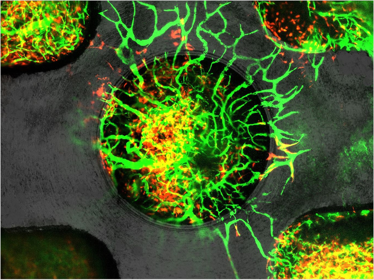 Looking at tissue healing around an implant in real-time through a microscope. Blood vessels are shown in green, perivascular mesenchymal cells in red and the metallic implant in dark gray. Photo provided by Niloufar Khosravi.