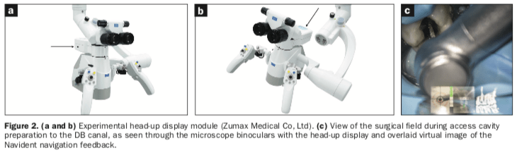 Endodontics access