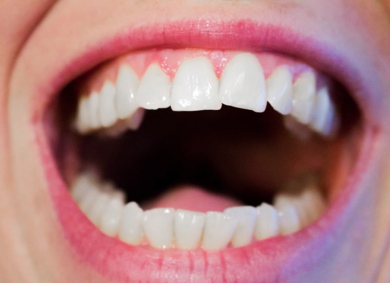 oral cavity, Curaden, curaprox,