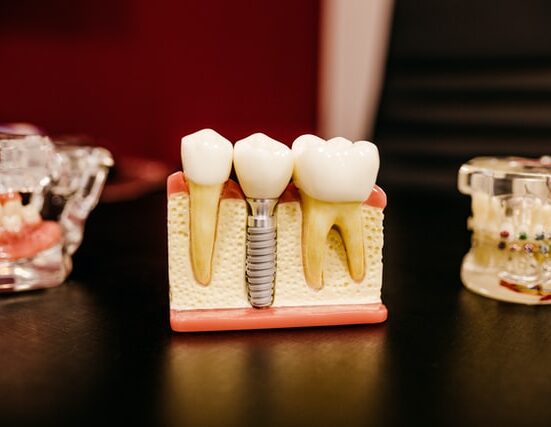 spring dental