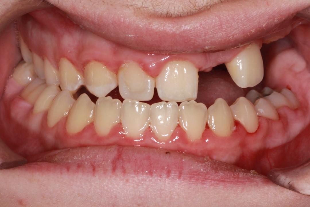 congenital growth defect