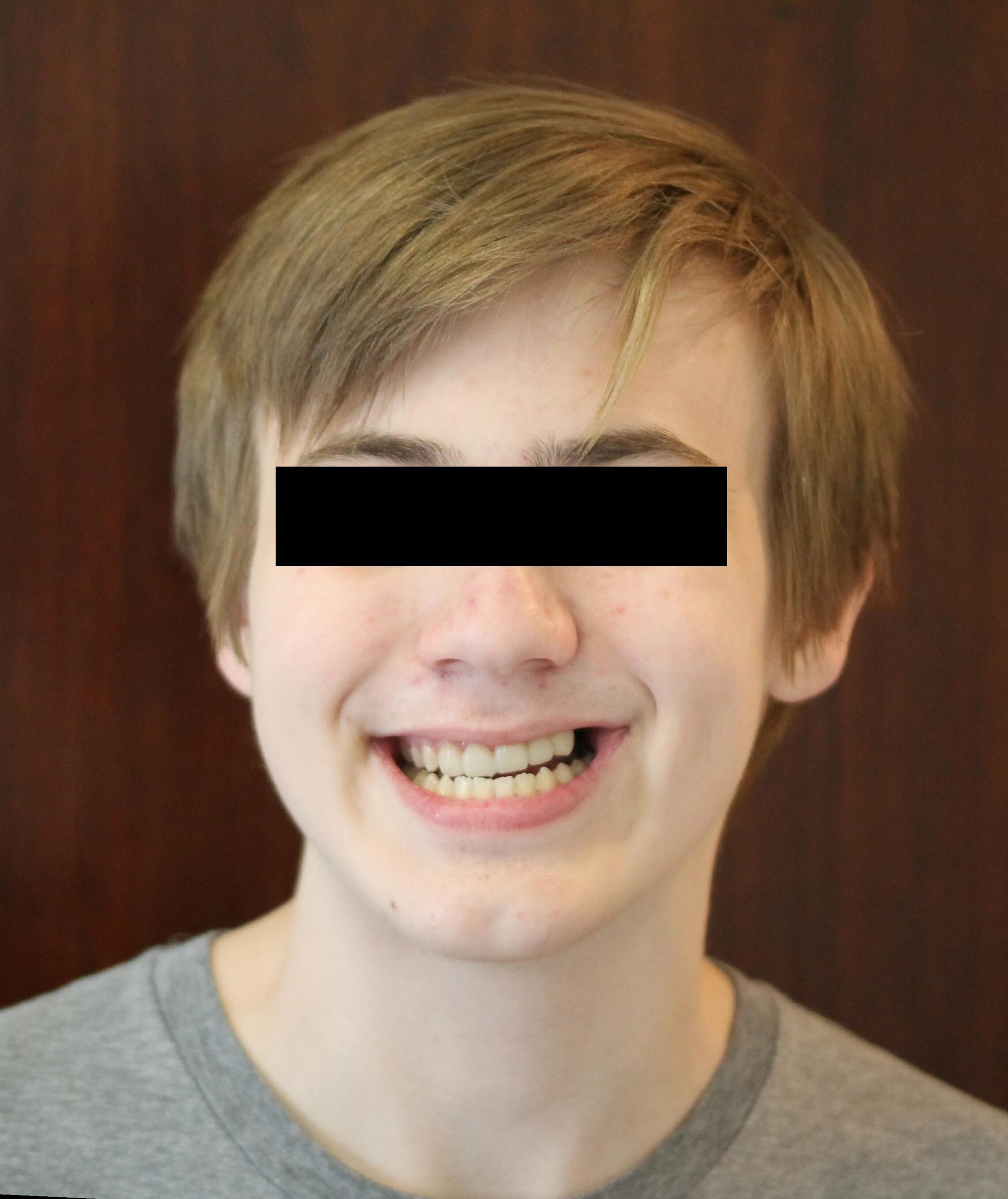 congenital growth defect