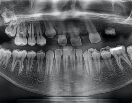 congenital growth defect
