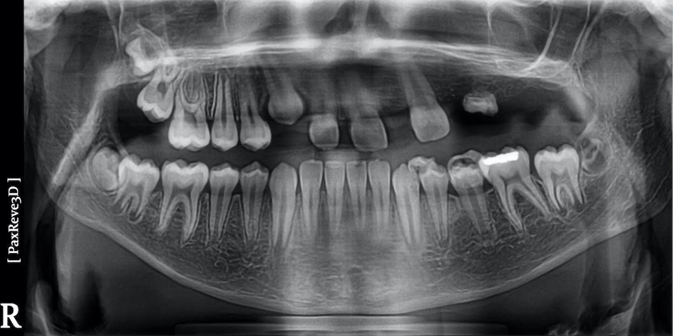 congenital growth defect