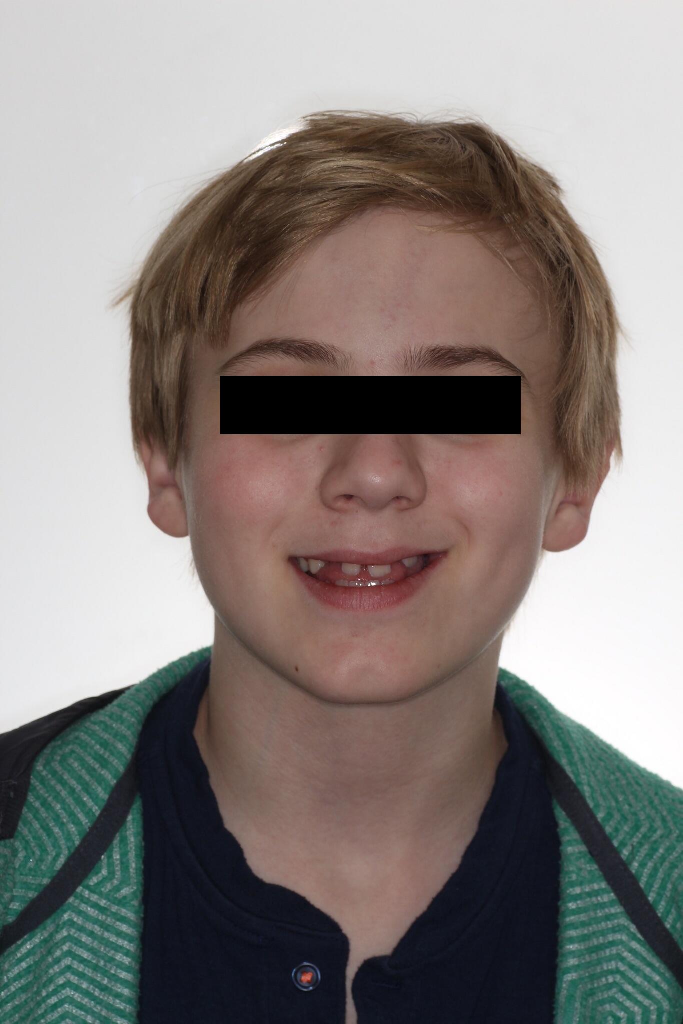 congenital growth defect