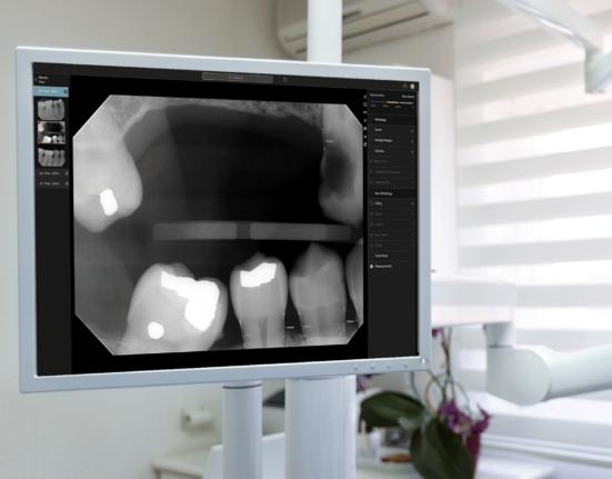 FDA, pearl, dental x-rays