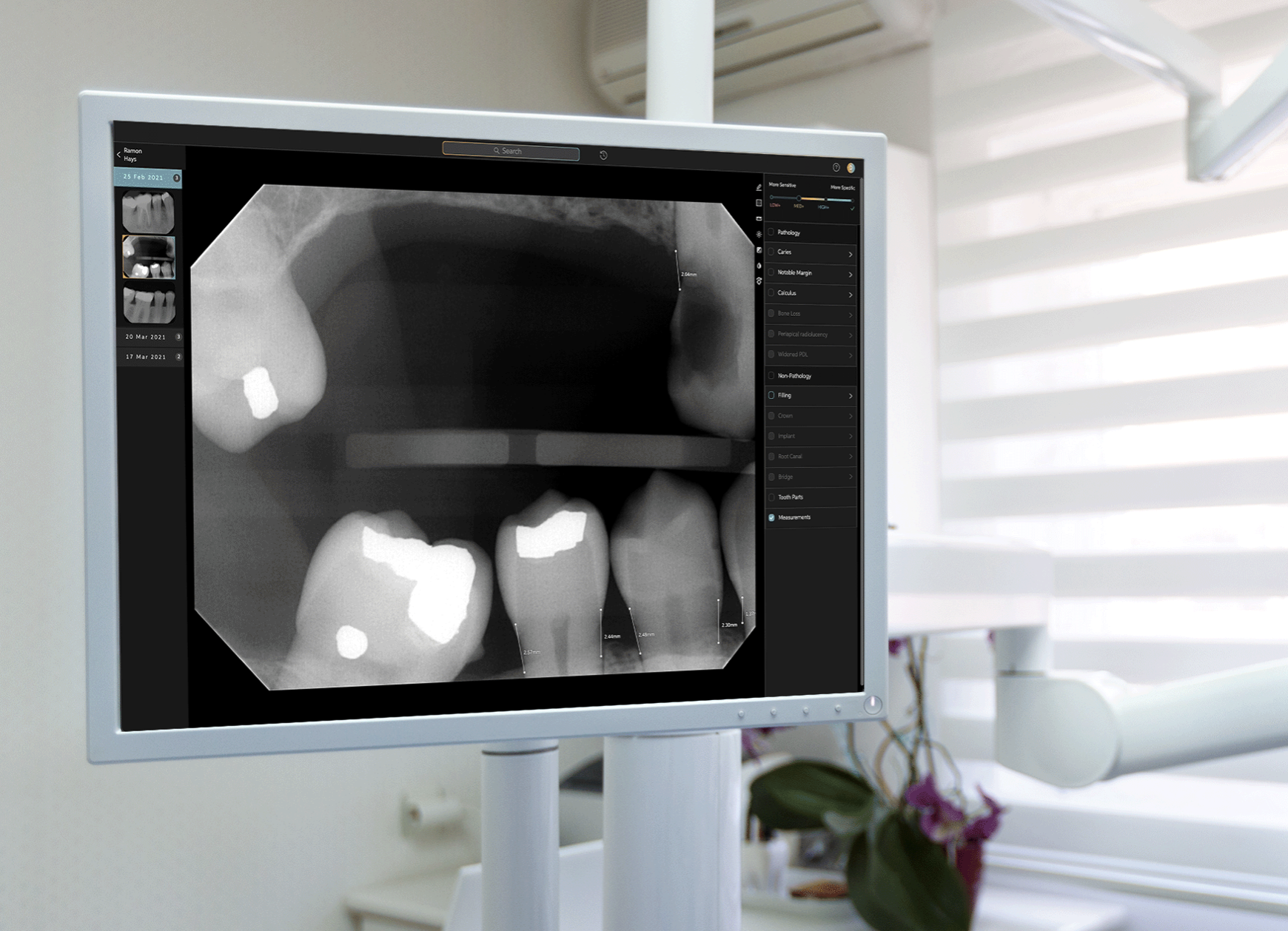 FDA, pearl, dental x-rays