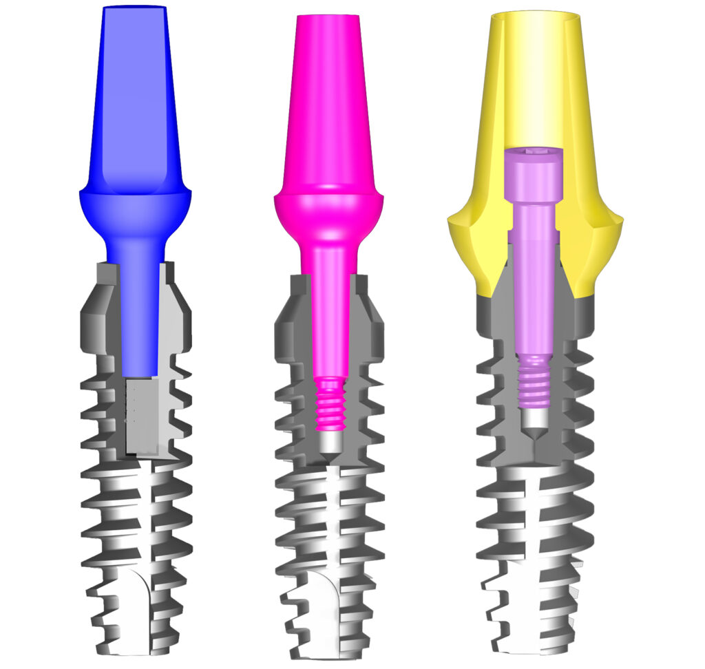implant challenges