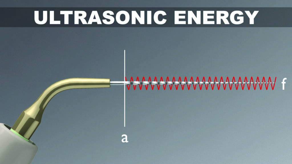 endodontic