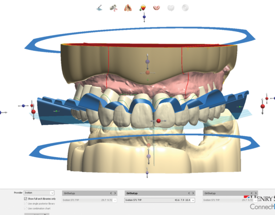 dentures