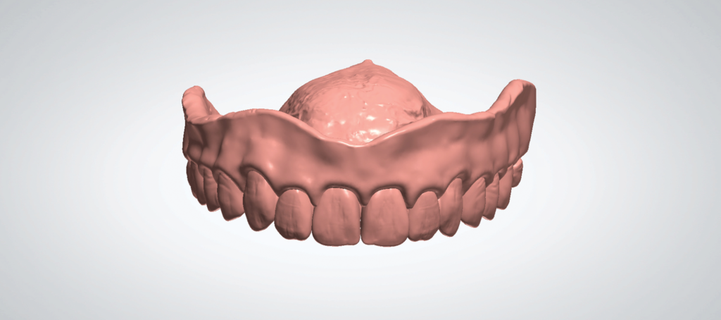 dentures