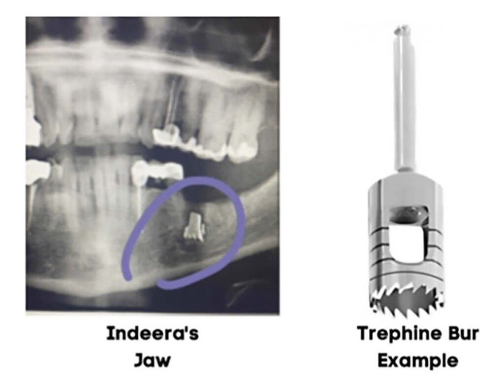 texas oral surgeon