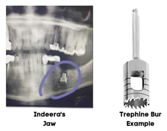 texas oral surgeon