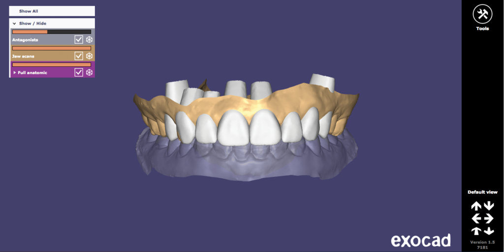 aesthetic crown lengthening