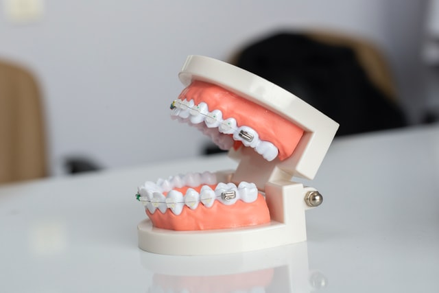 dental techniques