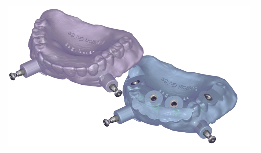 exocad
