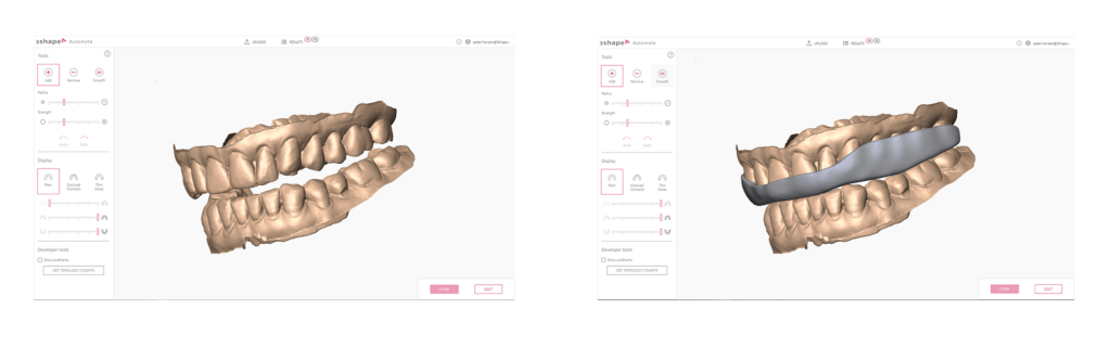 3shape automate