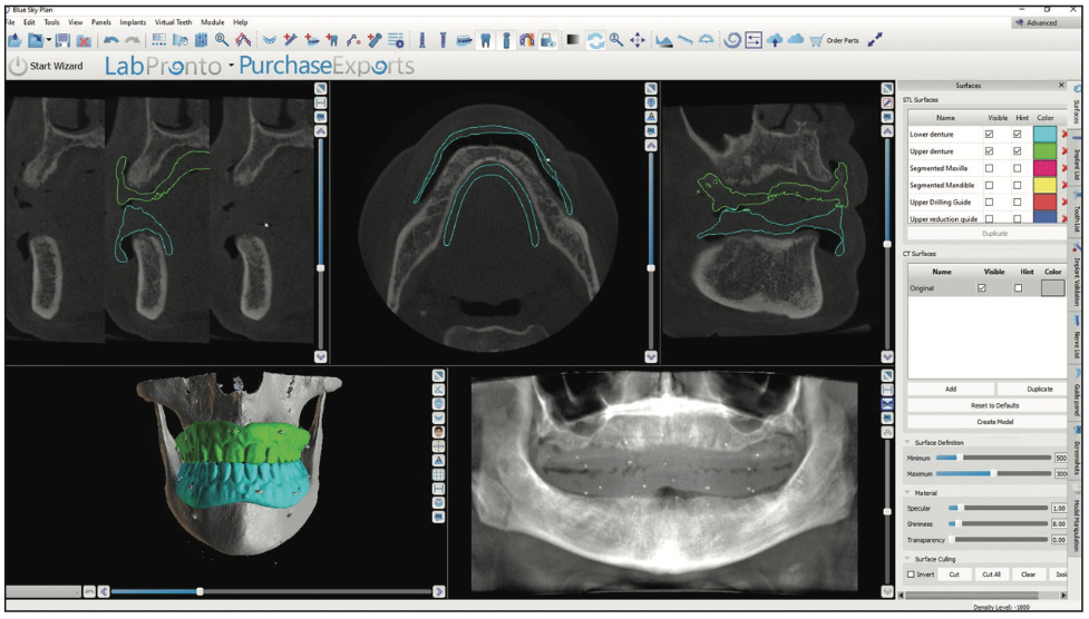 bone reduction
