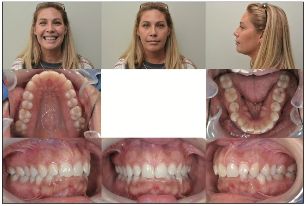 dental photography
