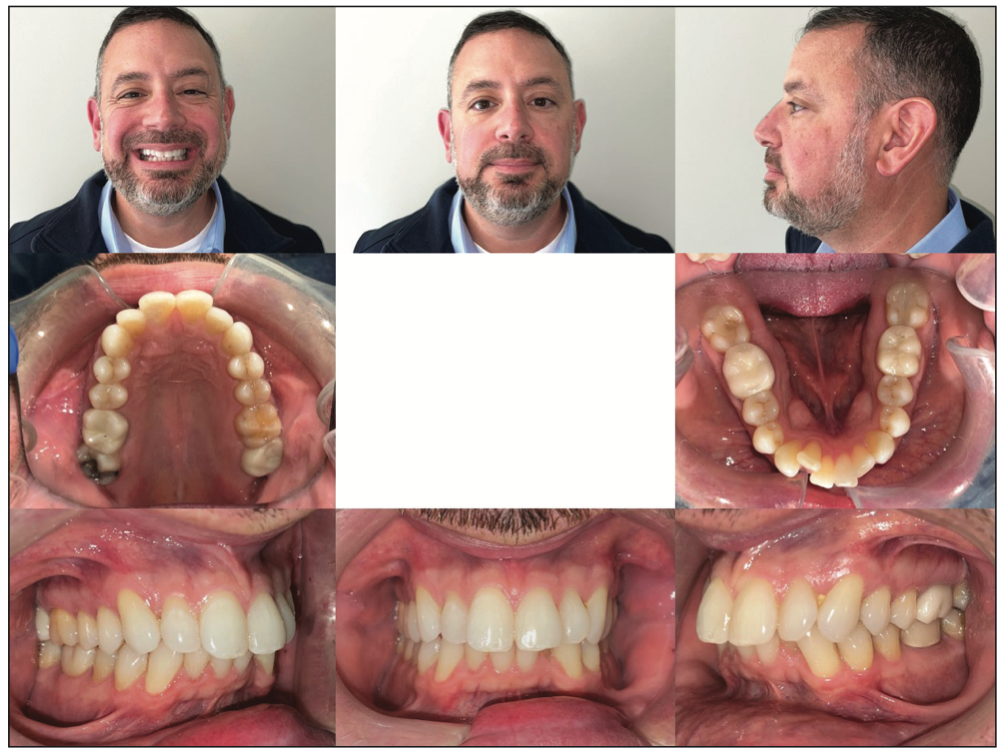 dental photography
