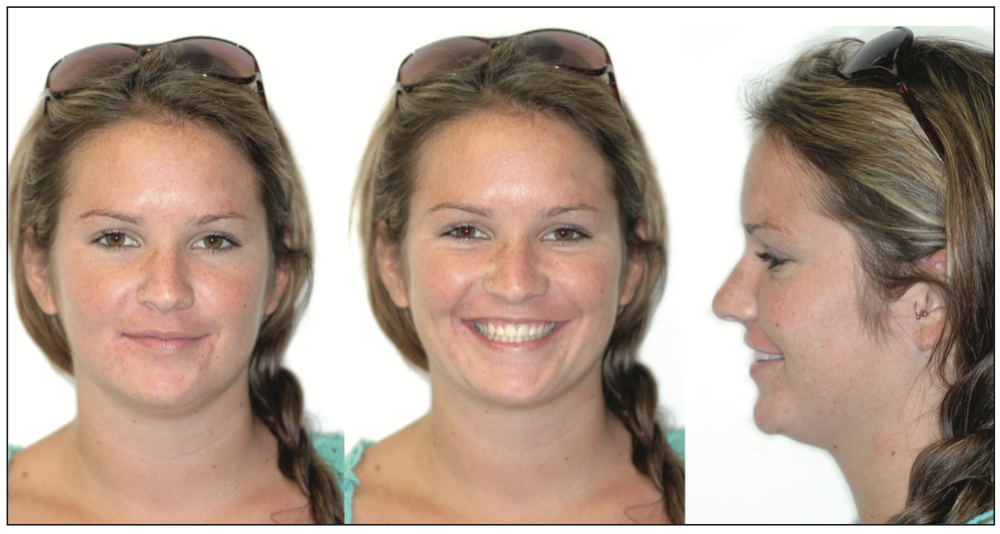 dental photography