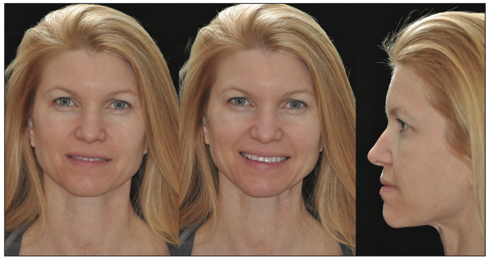 dental photography